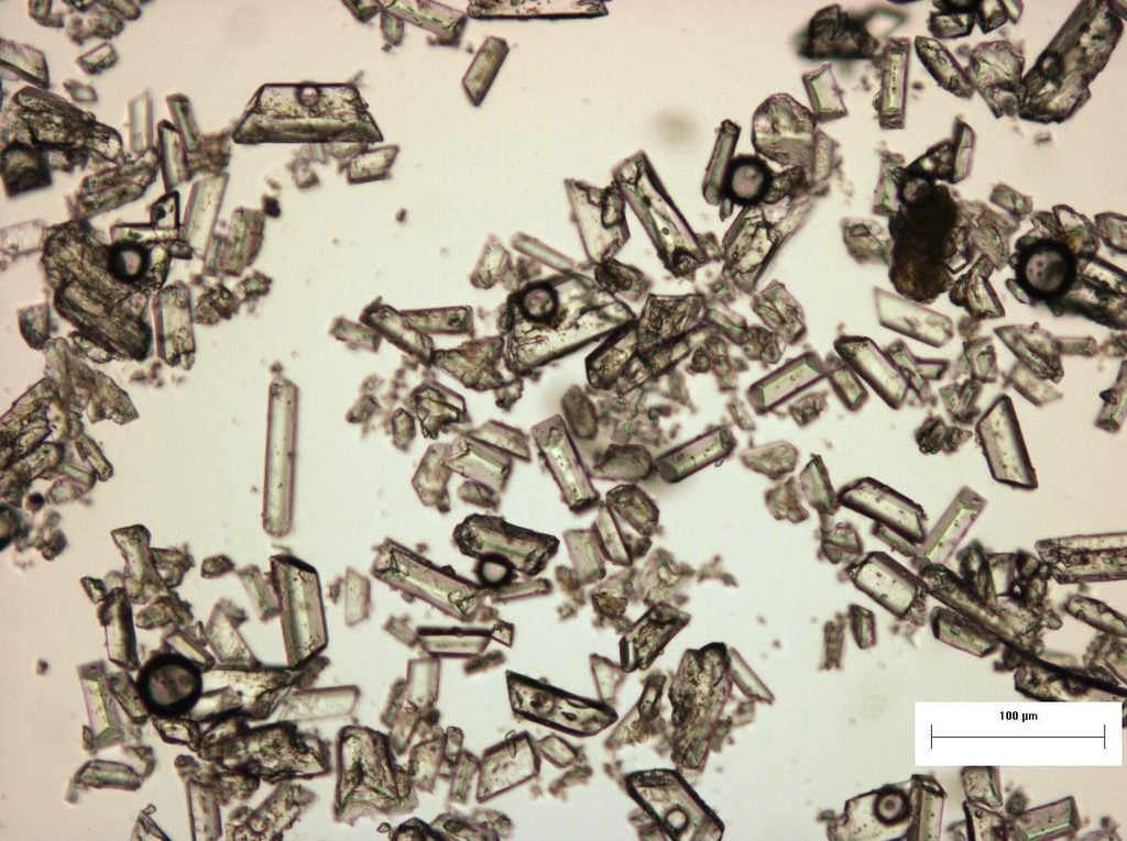 struvite crystals