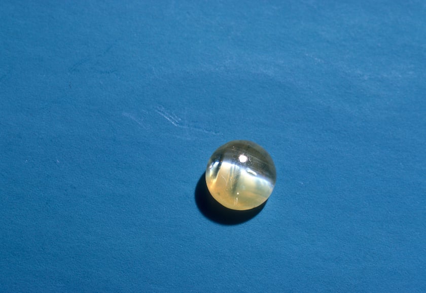 cat's eye cabochon