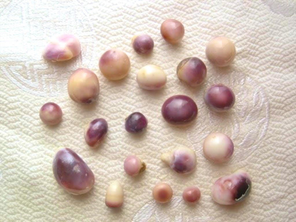 quahog pearls with different shapes and colors