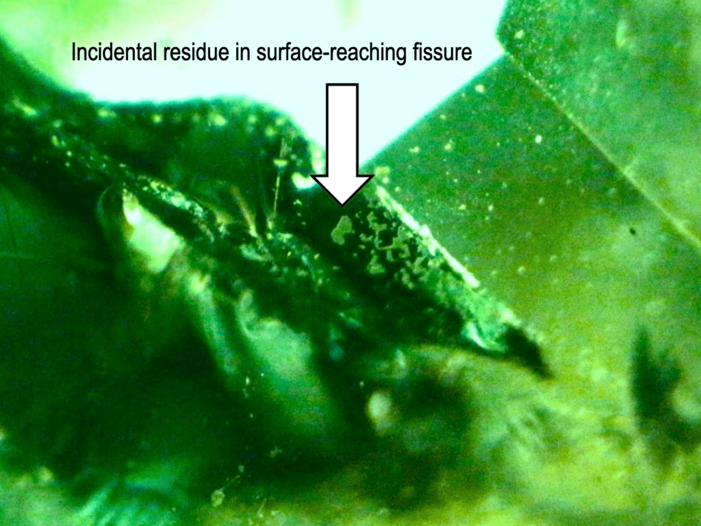 incidental residue in fissure